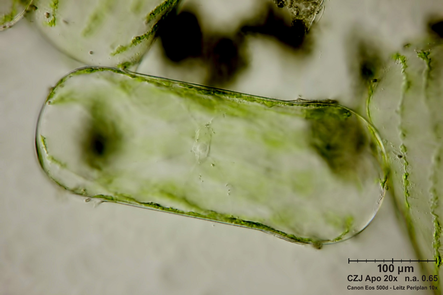 Spirogyra - zigospora